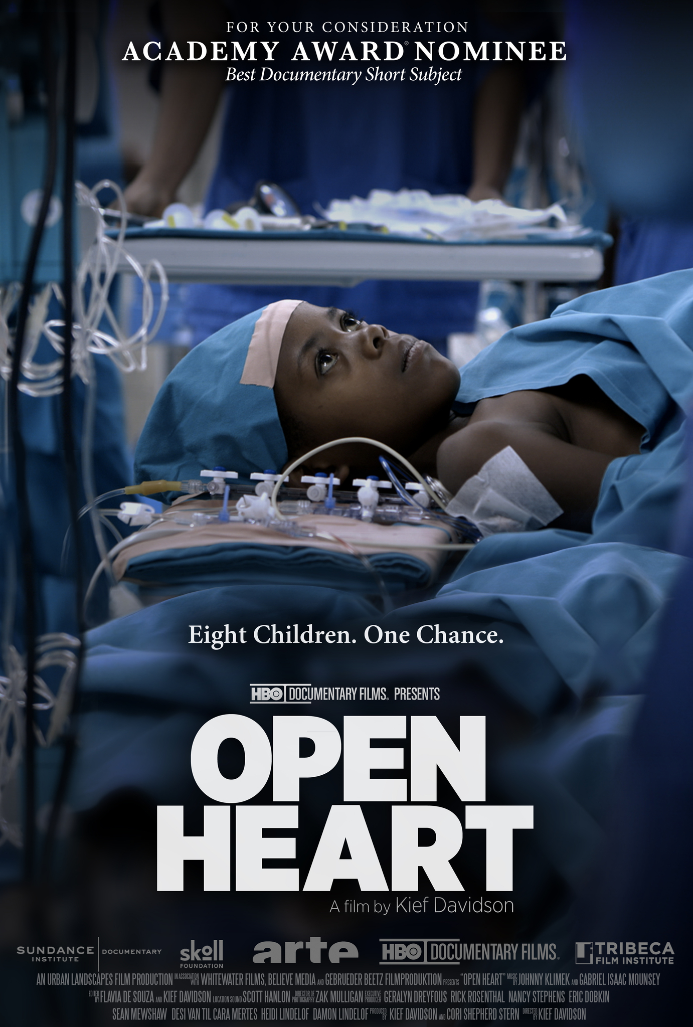 Open Heart